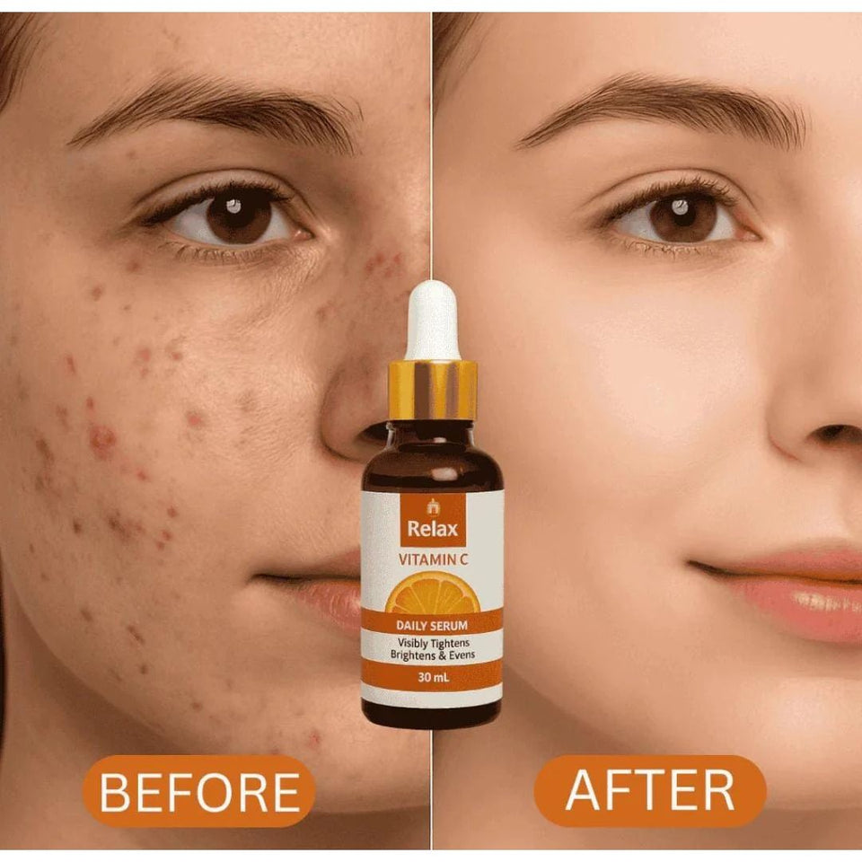 Relax Vitamin C Daily Face Serum (30ml)